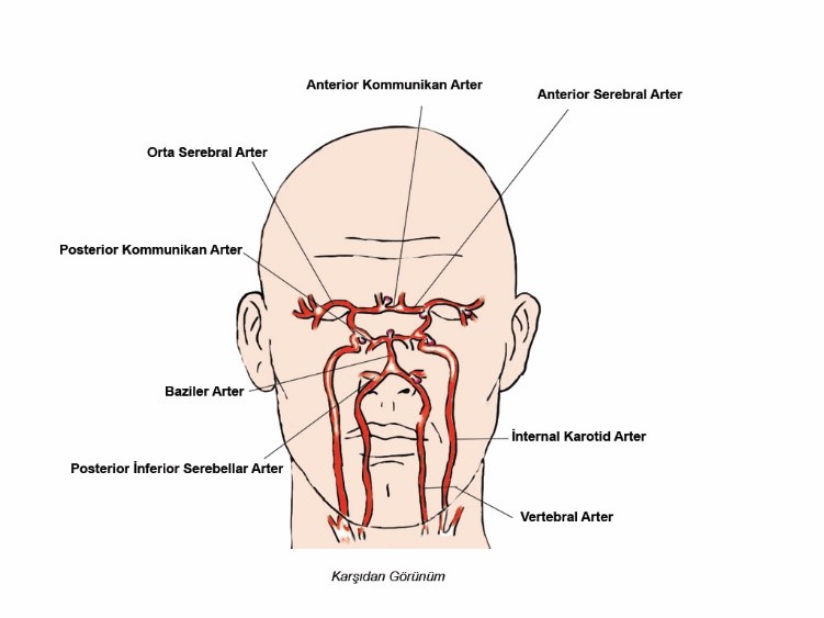 vertebral arter sendromu yüksek tansiyon