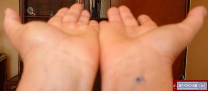 A close up of a hand

Description automatically generated